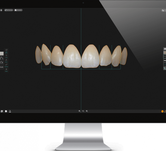 Естетска Стоматологија (Digital Smile Design)