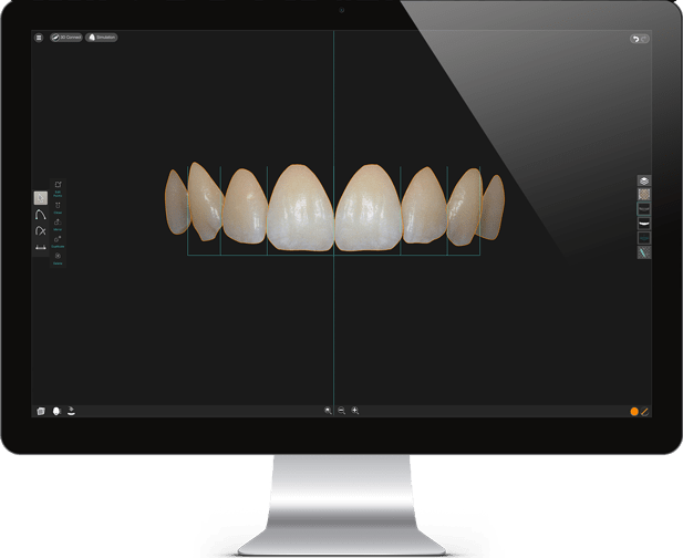 Естетска Стоматологија (Digital Smile Design)